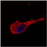 NEFM Antibody in Immunocytochemistry (ICC/IF)