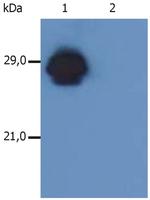 HLA-DR/DP Antibody in Western Blot (WB)