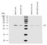 SIT Antibody in Western Blot (WB)