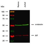 SIT Antibody in Western Blot (WB)