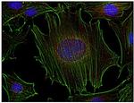 Fyn Antibody in Immunocytochemistry (ICC/IF)