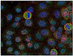 Fyn Antibody in Immunocytochemistry (ICC/IF)