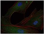 Fyn Antibody in Immunocytochemistry (ICC/IF)