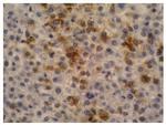 AFP Antibody in Immunohistochemistry (Paraffin) (IHC (P))