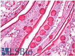 MUC5AC Antibody in Immunohistochemistry (Paraffin) (IHC (P))