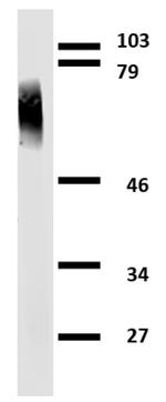 Apolipoprotein J Antibody in Western Blot (WB)