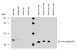 beta-2 Microglobulin Antibody in Western Blot (WB)