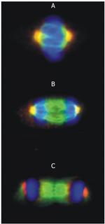 gamma Tubulin Antibody in Immunocytochemistry (ICC/IF)