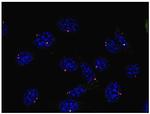 gamma Tubulin Antibody in Immunocytochemistry (ICC/IF)