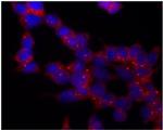 gamma Tubulin Antibody in Immunocytochemistry (ICC/IF)