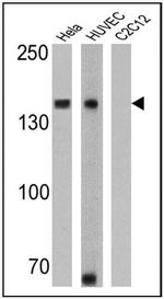 N-cadherin Antibody in Western Blot (WB)