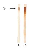 Fibrinogen Antibody in Western Blot (WB)