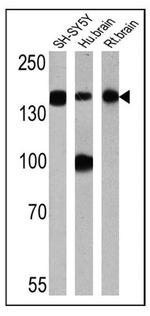 NEFM Antibody in Western Blot (WB)