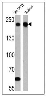 NF-H Antibody in Western Blot (WB)