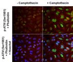 Phospho-ATM (Ser1981) Antibody