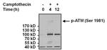 Phospho-ATM (Ser1981) Antibody