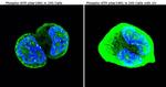 Phospho-ATM (Ser1981) Antibody