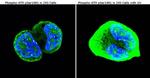 Phospho-ATM (Ser1981) Antibody in Immunocytochemistry (ICC/IF)