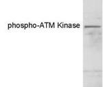 Phospho-ATM (Ser1981) Antibody in Western Blot (WB)