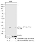 Phospho-Histone H2A.X (Ser139) Antibody