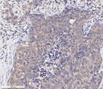 Phospho-AKT1 (Ser473) Antibody in Immunohistochemistry (Paraffin) (IHC (P))