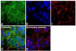 TBK1 Antibody in Immunocytochemistry (ICC/IF)