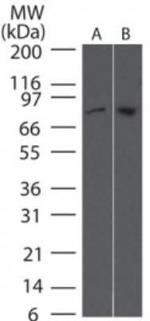 TBK1 Antibody in Western Blot (WB)