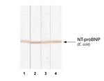 pro-Brain Natriuretic Peptide Antibody in Western Blot (WB)