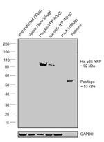 6x-His Tag Antibody in Western Blot (WB)