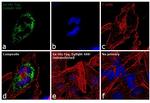 6x-His Tag Antibody in Immunocytochemistry (ICC/IF)