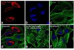 6x-His Tag Antibody in Immunocytochemistry (ICC/IF)