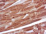 Sarcomeric alpha Actin Antibody in Immunohistochemistry (Paraffin) (IHC (P))