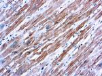 Sarcomeric alpha Actinin Antibody in Immunohistochemistry (Paraffin) (IHC (P))