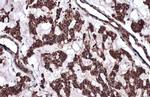 ATM Antibody in Immunohistochemistry (Paraffin) (IHC (P))