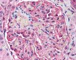 ATM Antibody in Immunohistochemistry (Paraffin) (IHC (P))