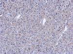 ATM Antibody in Immunohistochemistry (Paraffin) (IHC (P))