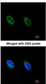 ATR Antibody in Immunocytochemistry (ICC/IF)