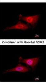 Cdc34 Antibody in Immunocytochemistry (ICC/IF)