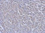 Cdc34 Antibody in Immunohistochemistry (Paraffin) (IHC (P))