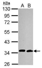 Cdc34 Antibody in Western Blot (WB)