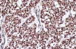 Estrogen Receptor beta Antibody in Immunohistochemistry (Paraffin) (IHC (P))