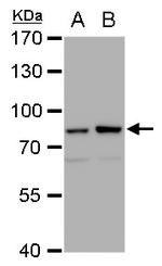 MRE11 Antibody in Western Blot (WB)