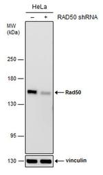 RAD50 Antibody