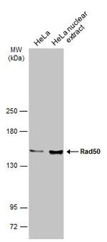 RAD50 Antibody in Western Blot (WB)