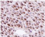 RAD51 Antibody in Immunohistochemistry (Paraffin) (IHC (P))