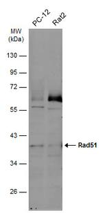 RAD51 Antibody in Western Blot (WB)