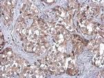 TSG101 Antibody in Immunohistochemistry (Paraffin) (IHC (P))