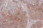 TSG101 Antibody in Immunohistochemistry (Paraffin) (IHC (P))