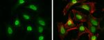 CtIP Antibody in Immunocytochemistry (ICC/IF)