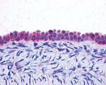 C/EBP beta Antibody in Immunohistochemistry (IHC)